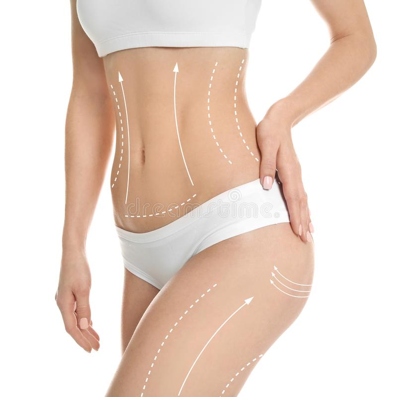 young-woman-marks-liposuction-operation-young-woman-marks-liposuction-operation-white-background-cosmetic-125376930